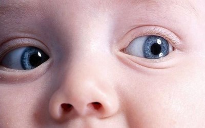Слепота обоих глаз у младенца - обследование, лечение
